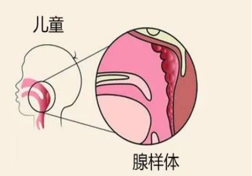 二胎時(shí)間間隔多久性別有差異，附生二胎注意事項(xiàng)